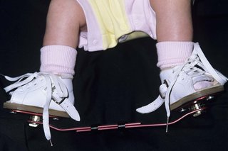 A baby's legs. On their feet they're wearing white shoes with laces and buckles. The soles of the shoes are attached to a red metal bar to keep their feet in position.
