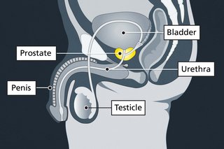 Diagram showing the prostate gland underneath the bladder.