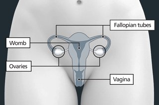 Diagram of the pelvic area with labels showing the womb, ovaries, fallopian tubes and vagina.